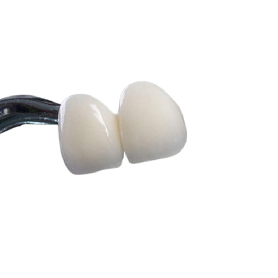 Corona dental de la buena circona de Biocompatibility no que irrita la limpieza fácil