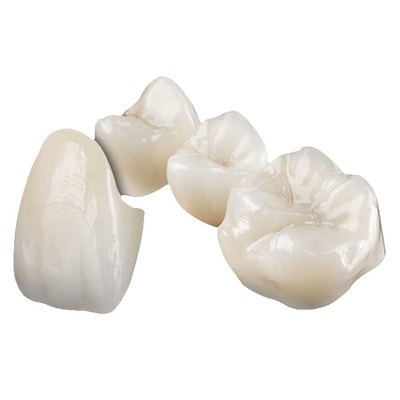 Corona dental de zirconia: Aparecido natural y perfectamente ajustado