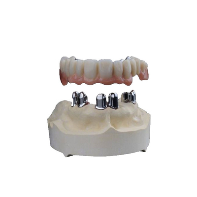 3D dental imprimió las coronas de la circona lleva - alto Biocompatibility resistente