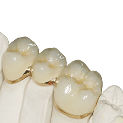 Corona temporal no irritante de la resina con buen Biocompatibility