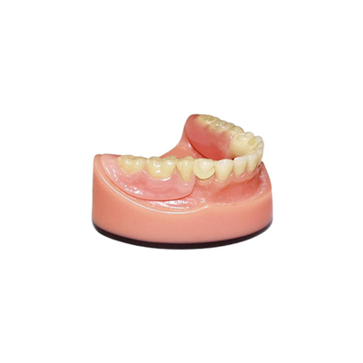 Sistema de exploración intraoral dental de la proyección de imagen del puente 3D Digitaces del OEM PFM