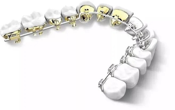 Braces Dentales Aparatos de Ortodoncia Fijo Side Back Invisible Lingual Brackets Estéticos Naturales