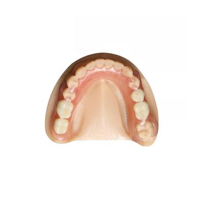 Laboratorio dental profesional de la dentadura desprendible dental de la corona de la circona del OEM