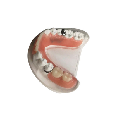 3D imprimió las dentaduras desprendibles por encargo dentales de la garantía de calidad de la corona de la circona