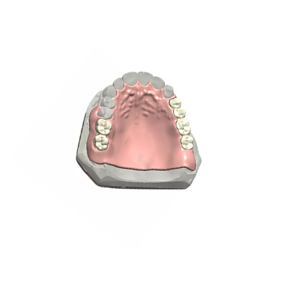 La garantía de calidad dental realista de la corona del aspecto PFM 3D imprimió modelos dentales