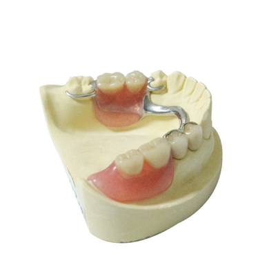 Dentaduras parciales desprendibles de los materiales del laboratorio dental sano de la dentadura por encargo