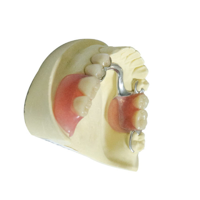 Dentaduras parciales desprendibles de acrílico de los productos dentales profesionales del laboratorio
