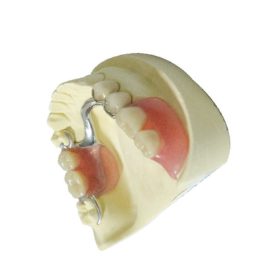 Dentaduras parciales desprendibles del laboratorio del polímero dental por encargo de los productos