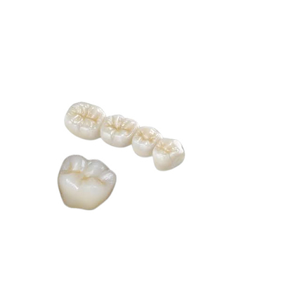 Resistencia a la corrosión fuerte de la circona de la corona dental del diente alto Biocompatibility