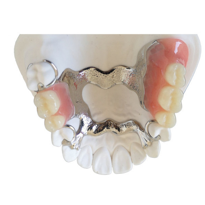 Puente dental alto Intermiscibility biológico de la corona de la impresora PFM del OEM 3D