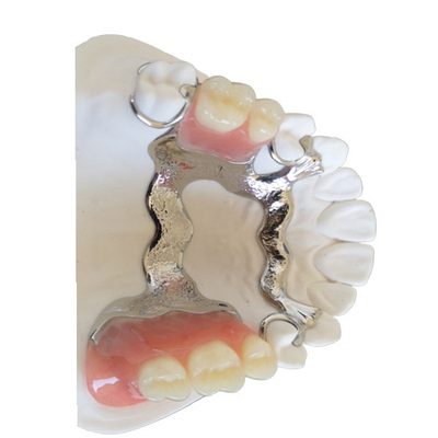 3D que imprimía la corona dental de PFM modificó alto Intermiscibility para requisitos particulares biológico