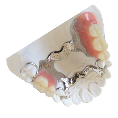 Porcelana dental dental de la corona FDA del laboratorio PFM fundida a la corona del metal