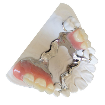 Corona modificada para requisitos particulares 3D del diente de PFM que imprime el puente dental de PFM