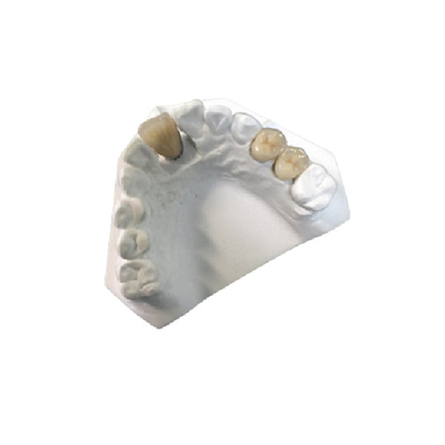 Condición de alta resistencia del OEM de la corona dental de la porcelana del oro amarillo nueva