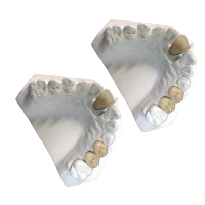 Corona dental de la porcelana del Co-Cr PFM de la corona de la porcelana del oro amarillo del laboratorio