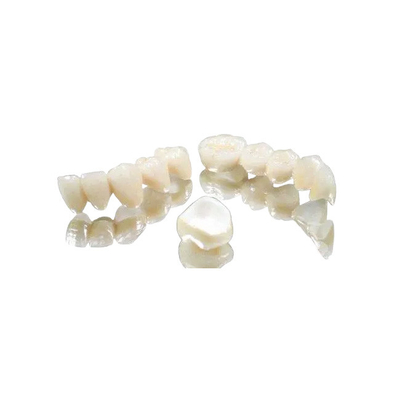 El doble completo de la corona de la corona de la experiencia del metal dental del puente terminó la corona fija del puente
