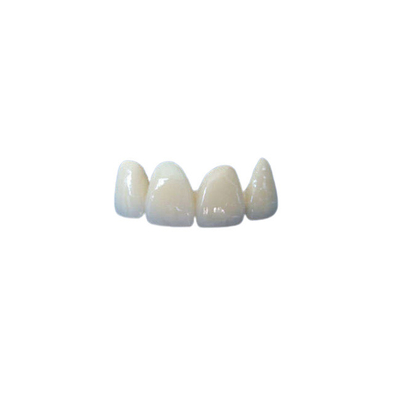 La corona dental de cerámica de la buena estabilidad cupo correctamente la higiene oral de alta calidad