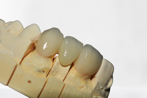 Limpio de alta calidad del puente dental de la corona de la buena estabilidad y ordenado limpios y ordenados