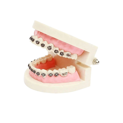 Resistencia dental buen Biocompatibility del ácido y del álcali de la corona de la porcelana