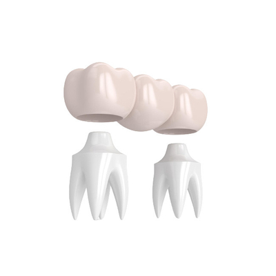 Puentes realistas del aspecto y color natural de la estabilidad fuerte dental de las coronas