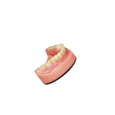 Sistema de exploración intraoral dental dental de la proyección de imagen del puente 3D Digitaces del laboratorio PFM de la dentadura