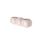 Puente dental de la porcelana dental de la corona de la porcelana para los resultados de Natural-mirada