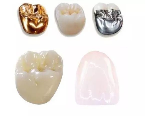 Buenas coronas y puentes dentales de Biocompatibility no fáciles llevar el establo del color