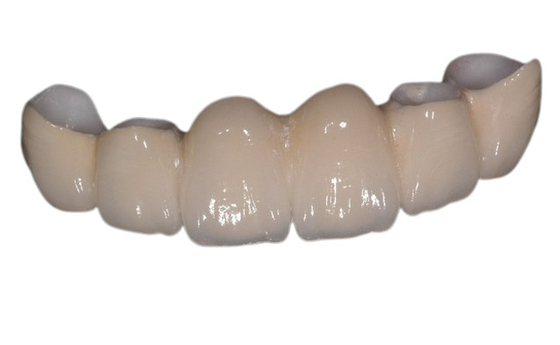 Corona dental de la porcelana superficial lisa restaurar la masticación de buena estabilidad del poder