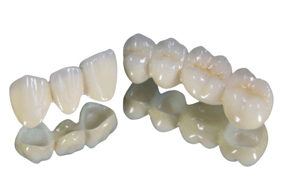 Establo fuerte del color de la resistencia de desgaste de la corona del diente de la porcelana de alta calidad