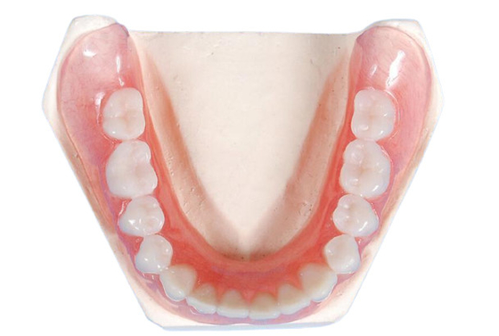 Establo fuerte del color de la resistencia de desgaste de la corona del diente de la porcelana de alta calidad