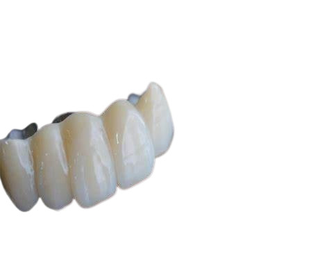 Puentes realistas del aspecto y color natural de la estabilidad fuerte dental de las coronas