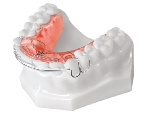 Los dispositivos ortodónticos dentales simples instalan el material biológico de la alta tecnología