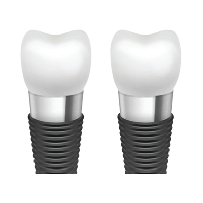 Aumento de la estética oral con las barras del implante dental