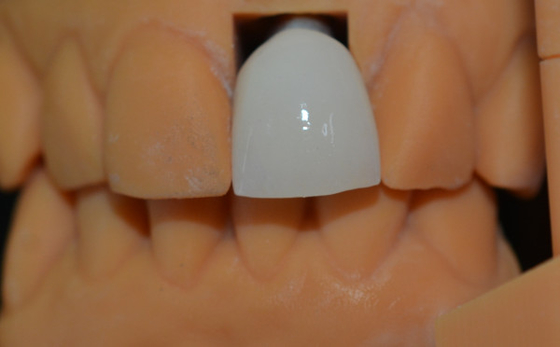 Mejore la eficiencia de su laboratorio con un laboratorio de prótesis dentales de alta durabilidad