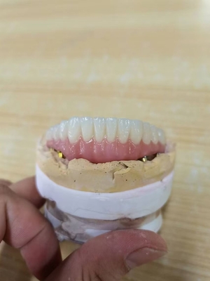 Elevando estándares nuestra garantía de calidad de la corona del implante dental