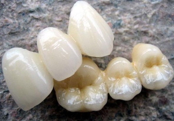 Estabilidad del color de encargo del puente dental de cerámica del Cr 3014652903 de PFM Co