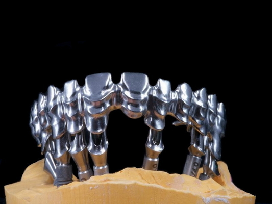 Fuerte altamente estético dental del puente del FDA 3014652903 PFM extremadamente