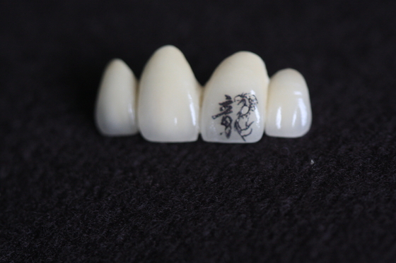 Imagen de corona dental PFM Personalización con patrones personalizados personalizados