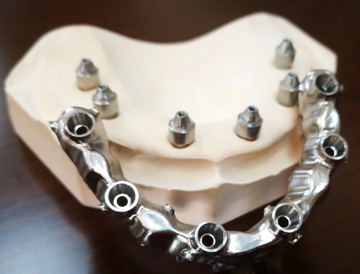Fuerte altamente estético dental del puente del FDA 3014652903 PFM extremadamente