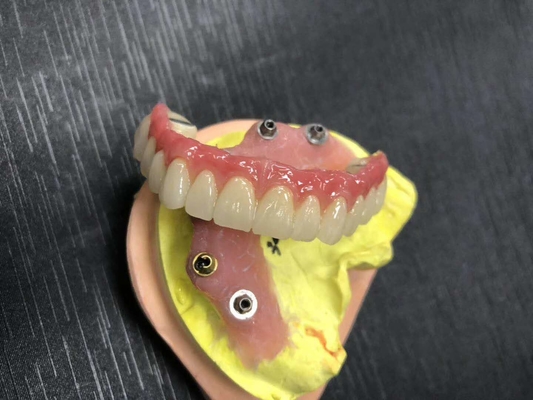 Fuerte altamente estético dental del puente del FDA 3014652903 PFM extremadamente