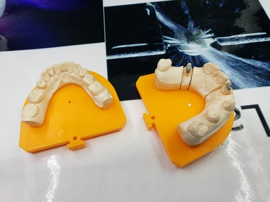 Material biológico de High Tech del metal PFM del puente dental lleno de la corona