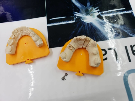 Material biológico de High Tech del metal PFM del puente dental lleno de la corona