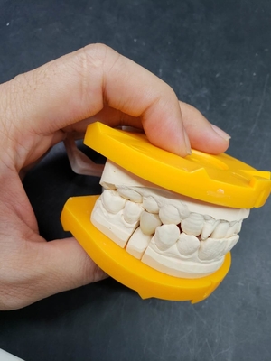 Innovación en el corazón de nuestras coronas dentales de cerámica