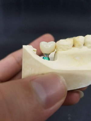 La corona biocompatible superficial lisa del diente de la circona fácil mantiene