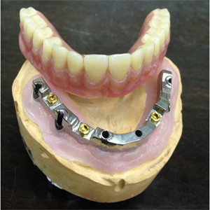 Implante dental de la seguridad del laboratorio de la alta dentadura inter biológica de la miscibilidad