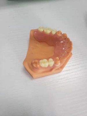 3D imprimió las dentaduras para los laboratorios dentales basados en los datos de Digitaces