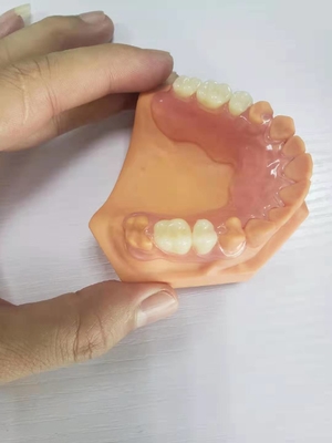 3D imprimió las dentaduras para los laboratorios dentales basados en los datos de Digitaces