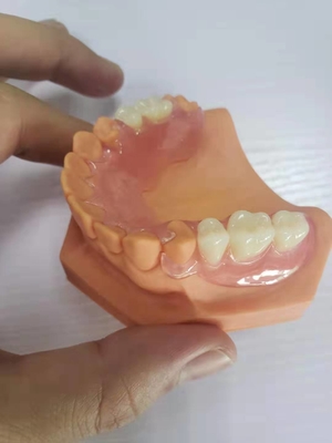3D imprimió las dentaduras para los laboratorios dentales basados en los datos de Digitaces