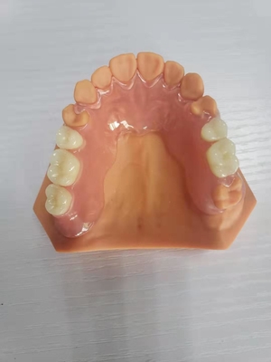 3D imprimió las dentaduras para los laboratorios dentales basados en los datos de Digitaces