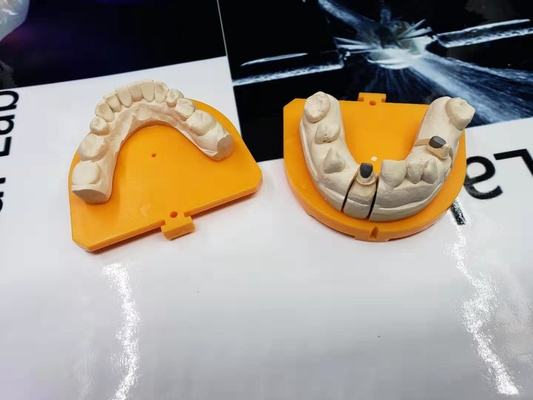 Corona de cerámica dental de la corona PFM de la porcelana de alta resistencia del oro amarillo